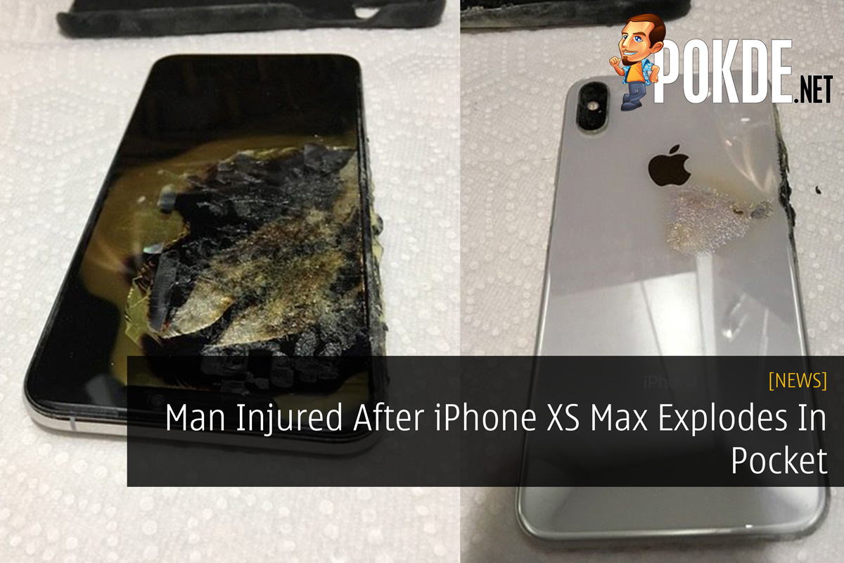 Man Injured After iPhone XS Max Explodes In Pocket 29